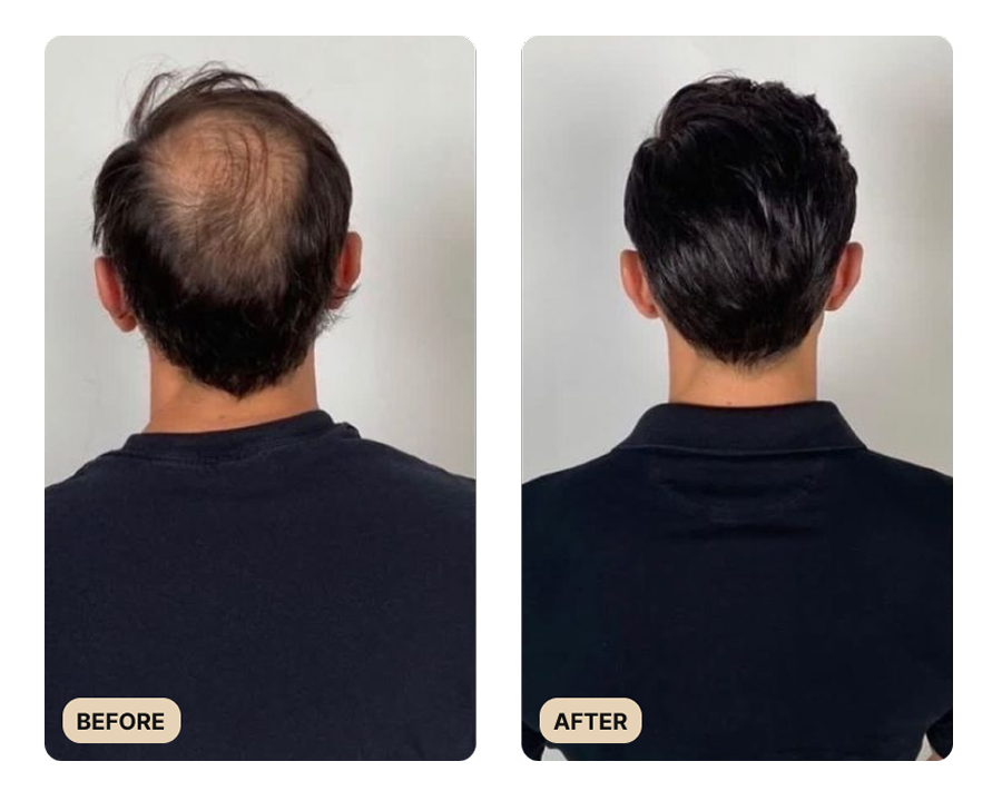 Root Activator Conditioner (TEST)