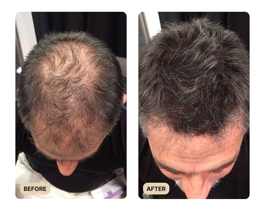 Full Hair Growth System (TEST)