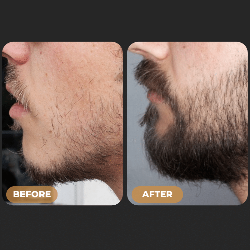SPARTAN™ - Beard Growth Oil
