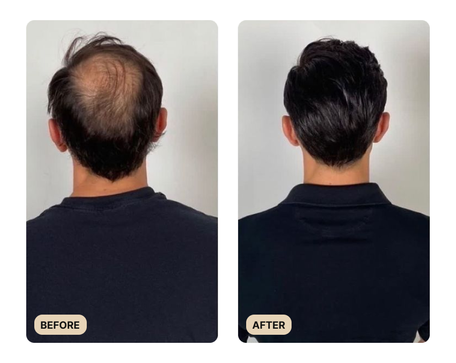 Full Hair Growth System (TEST)