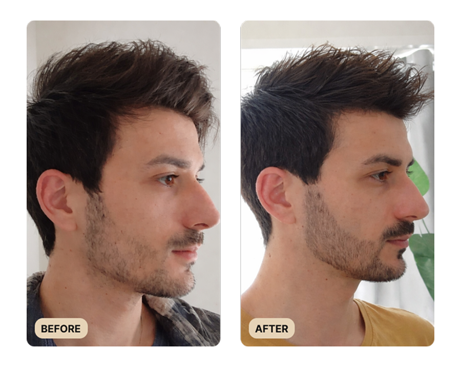 Beard Growth Kit (TEST)