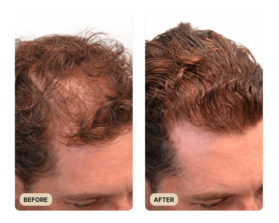 Root Activator Conditioner (TEST)