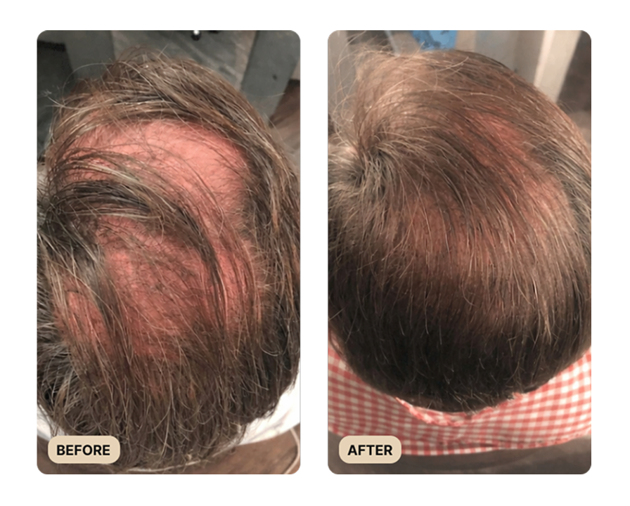 Root Activator Shampoo (TEST)