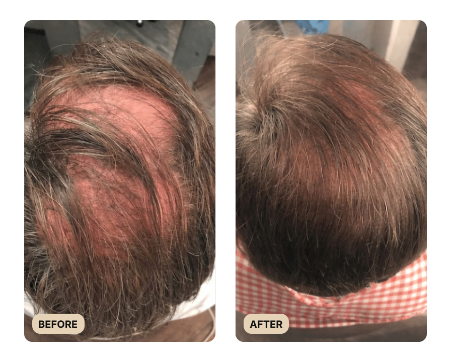 Root Activator Spray (TEST)