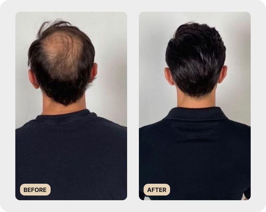 Premium Scalp Brush (TEST)
