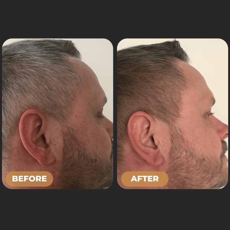 SPARTAN™ - Instant Hair Dye Shampoo