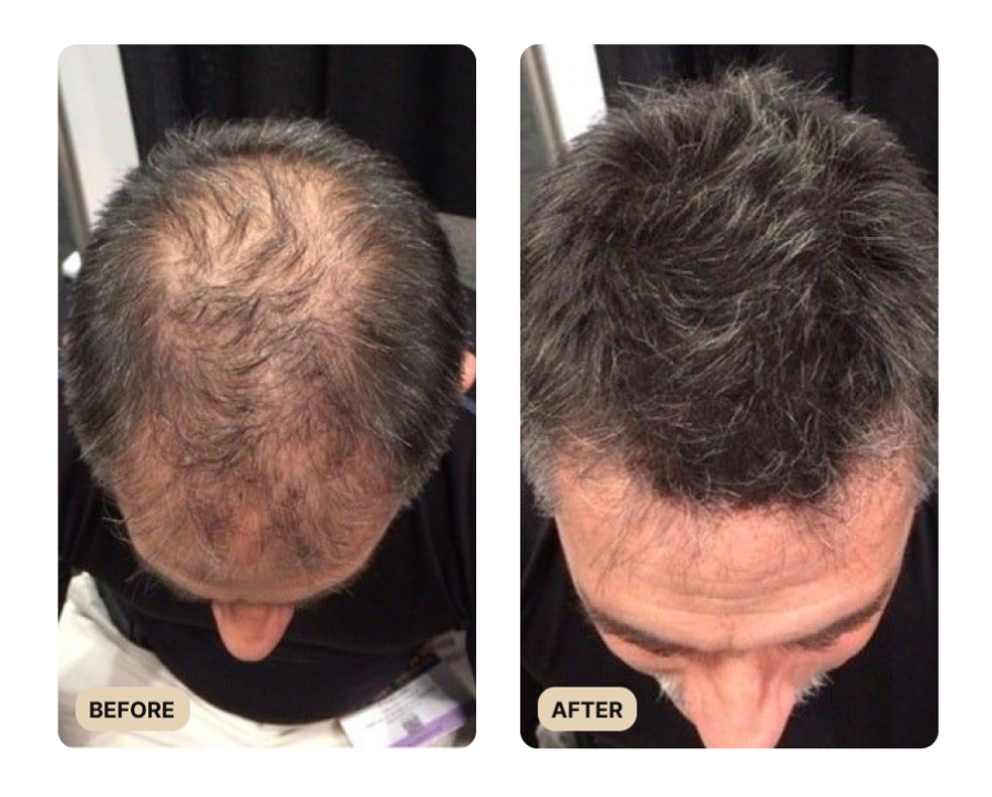 Root Activator Shampoo (TEST)