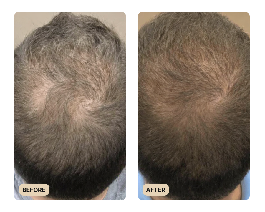 Root Activator Spray (TEST)