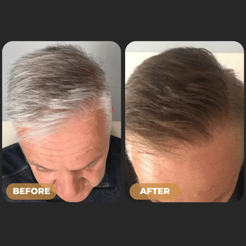 SPARTAN™ - Instant Hair Dye Shampoo